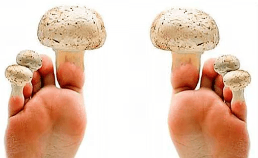 fungi on the nails