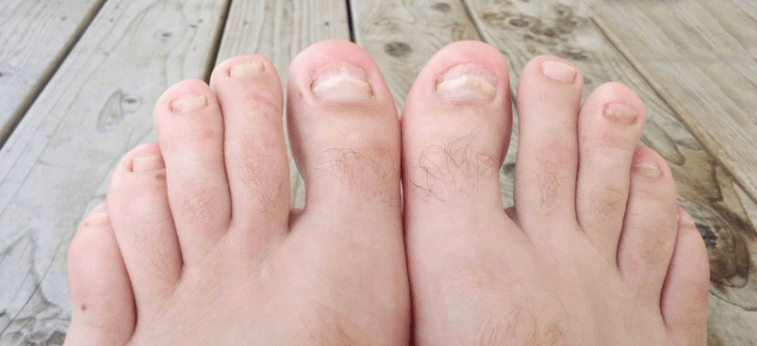 Nails