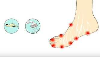 Causes of mushrooms on fingers