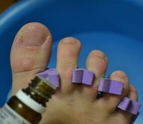 Preparation for the treatment of nails with anti-fungal drops